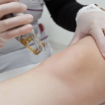 Laser Hair Removal Costs Near Chevy Chase